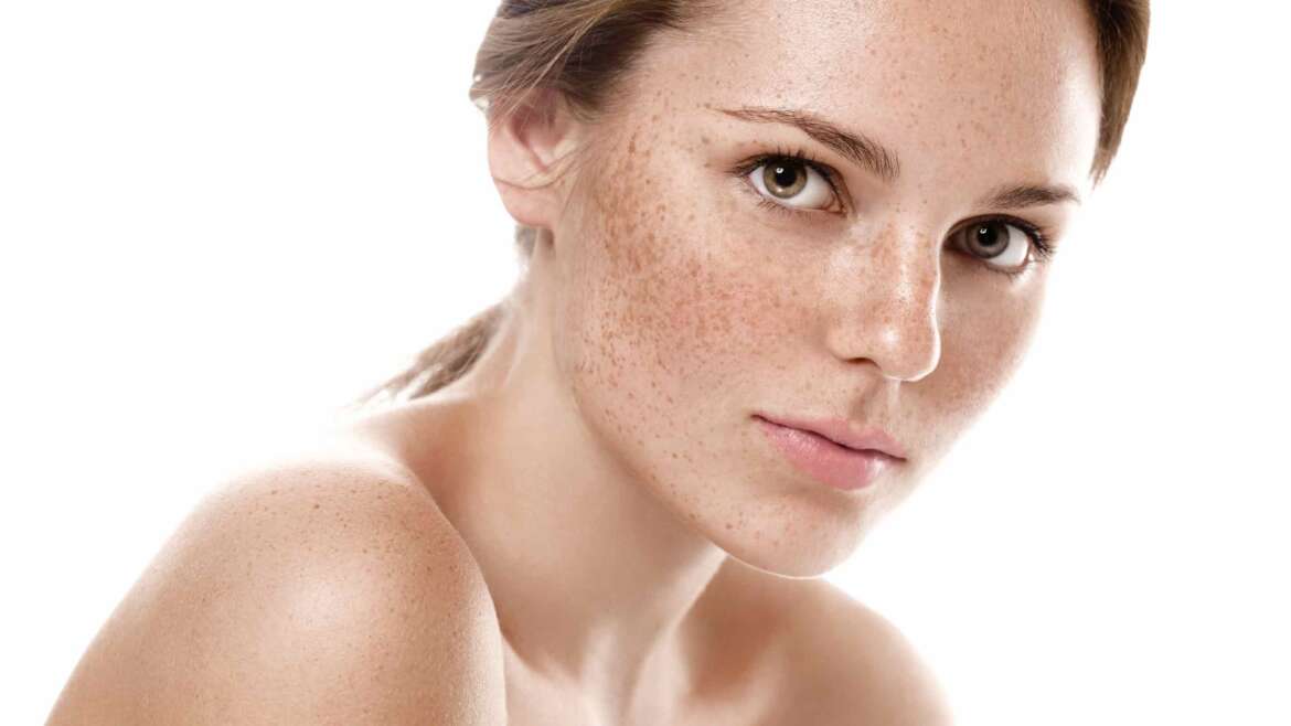 Demystifying Pigmentation: Types, Causes, and Treatment Options