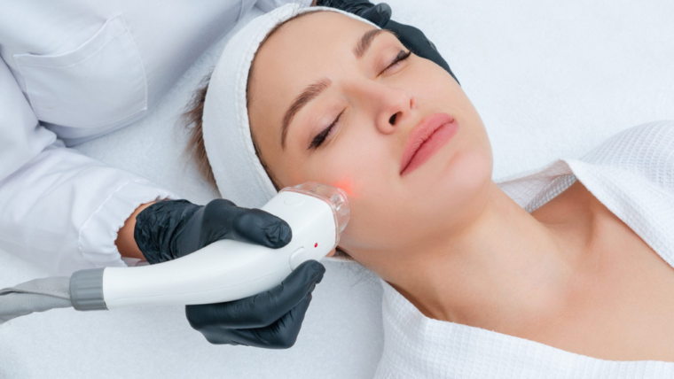 Laser Treatments for Acne and Acne Scars: Effectiveness and Benefits