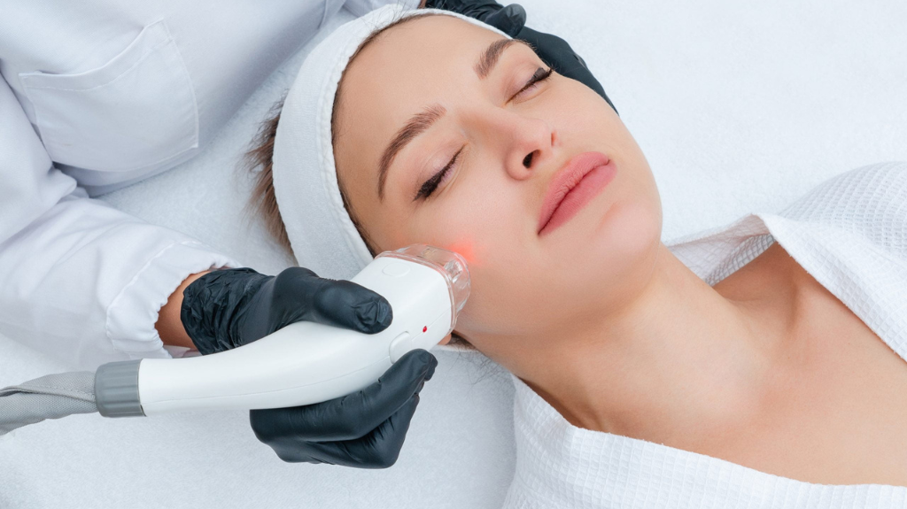 Laser Treatments for Acne and Acne Scars: Effectiveness and Benefits