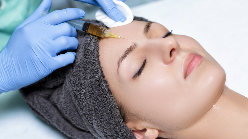 Exploring the Effectiveness of PRP in Treating Acne Scars and Other Skin Imperfections